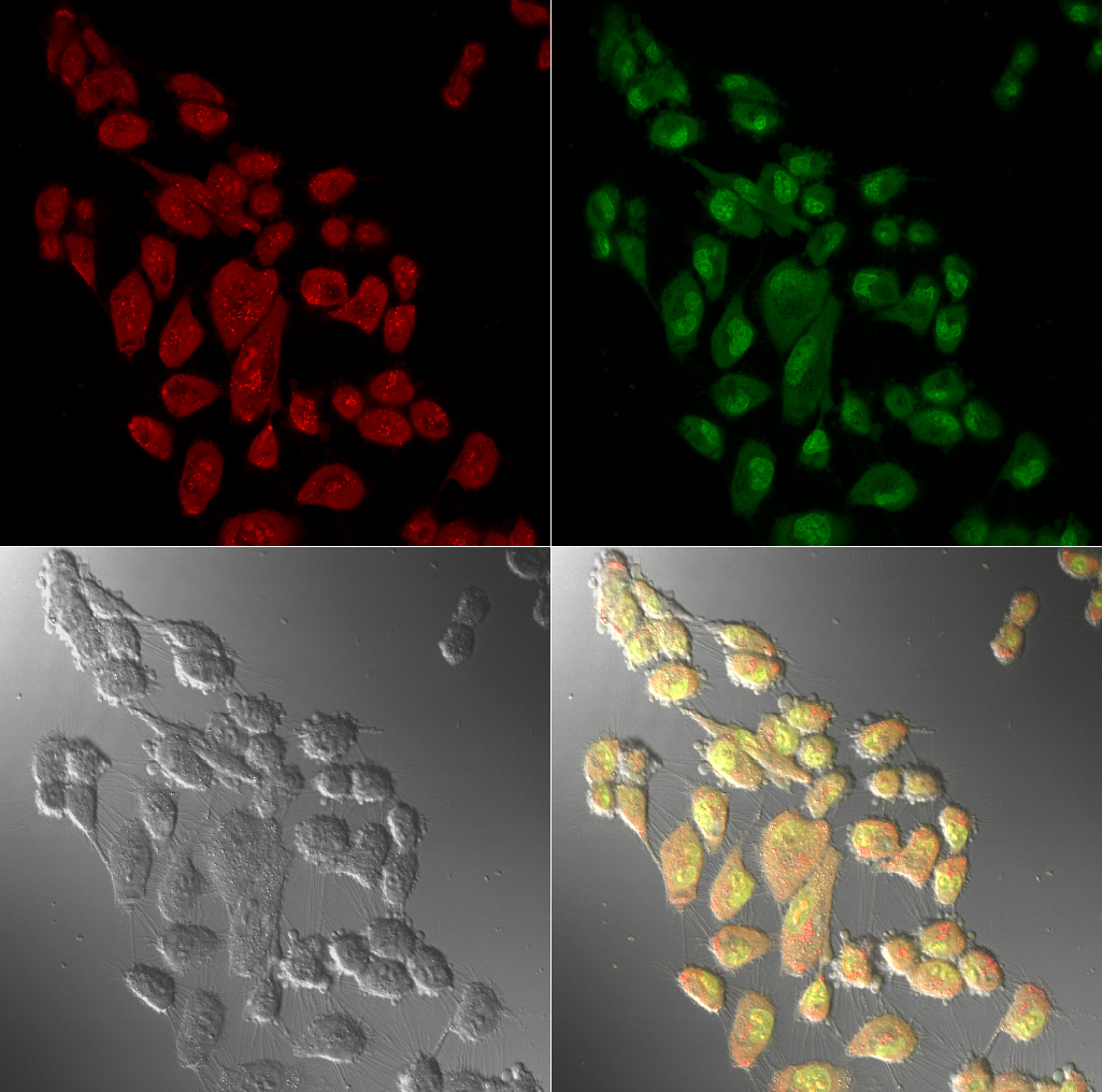 Split red/green fluorescence, DIC, and overlay images captured by Paige Bothwell, featuring SK Hep cells, a human hepatocellular carcinoma cell line, stained with acridine orange.