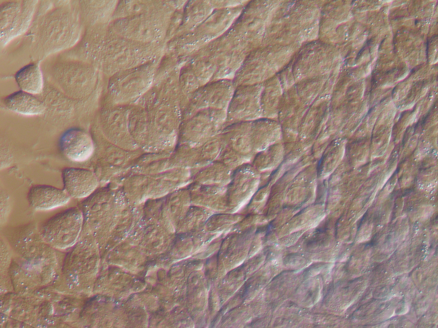 DIC image captured by Paige Bothwell, featuring EMT6 cells, a murine mammary carcinoma cell line, growing as a monolayer.
